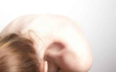 Migraines and Misalignment: What Your Neck Has to Do with It